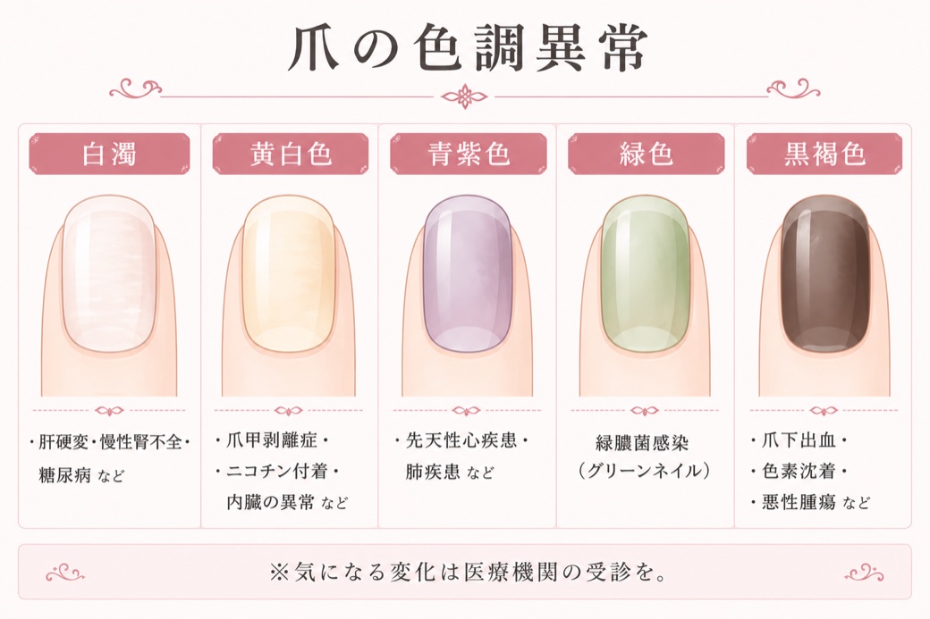 爪の色調異常のチャート：白濁(肝硬変・慢性腎不全・糖尿病)、黄白色(爪甲剥離症・ニコチン付着・内臓の異常)、青紫色(先天性心疾患・肺疾患)、緑色(緑膿菌感染=グリーンネイル)、黒褐色(爪下出血・色素沈着・悪性腫瘍)